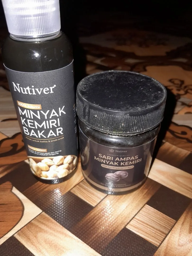 Foto ulasan (anonim)